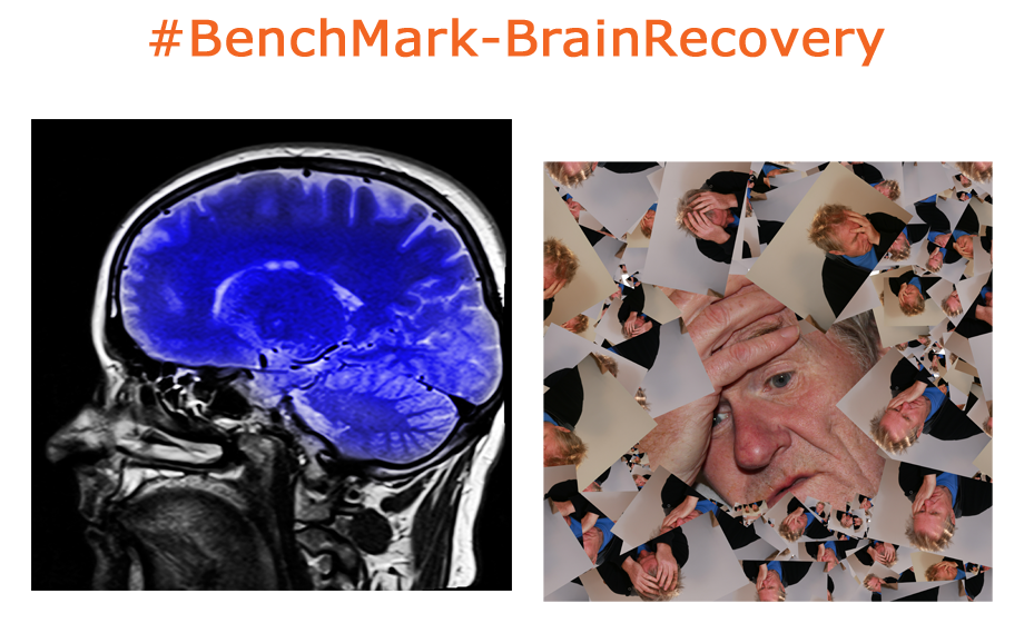 #BenchMark-BrainRecovey project for Global Health Science Institute.